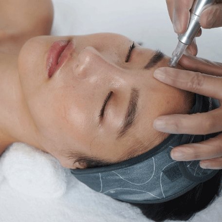 MICRONEEDLING AT THE BEST SKIN CLINIC IN FAREHAM