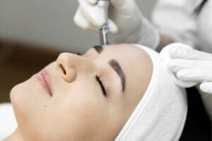 Microneedling facial kSPA Skin Clinic Fareham