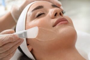 facial peel kSPA Skin Clinic Fareham