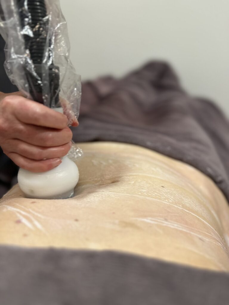 Cryo21Stomach