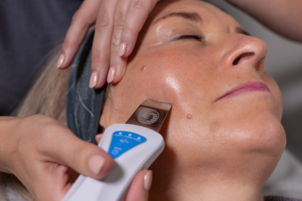 pro facials fareham