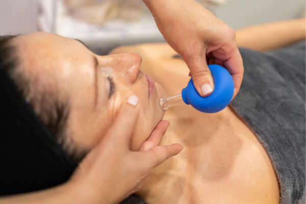 Facial Cupping kSPA Skin Clinic Whiteley, Fareham