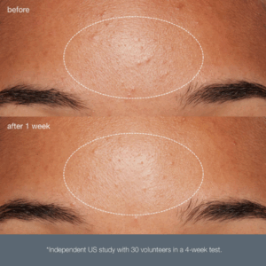 dermalogica daily microfoliant results