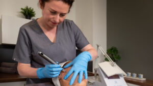 MicroneedlingKelly MicroneedlingKelly
